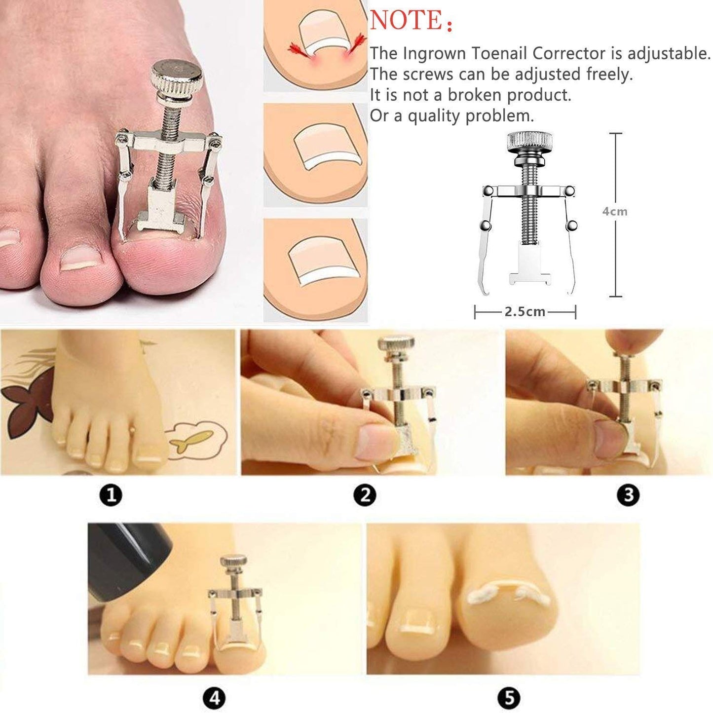 11Pcs/Set Ingrown Toenail Tools Kit Nail Care Pedicure