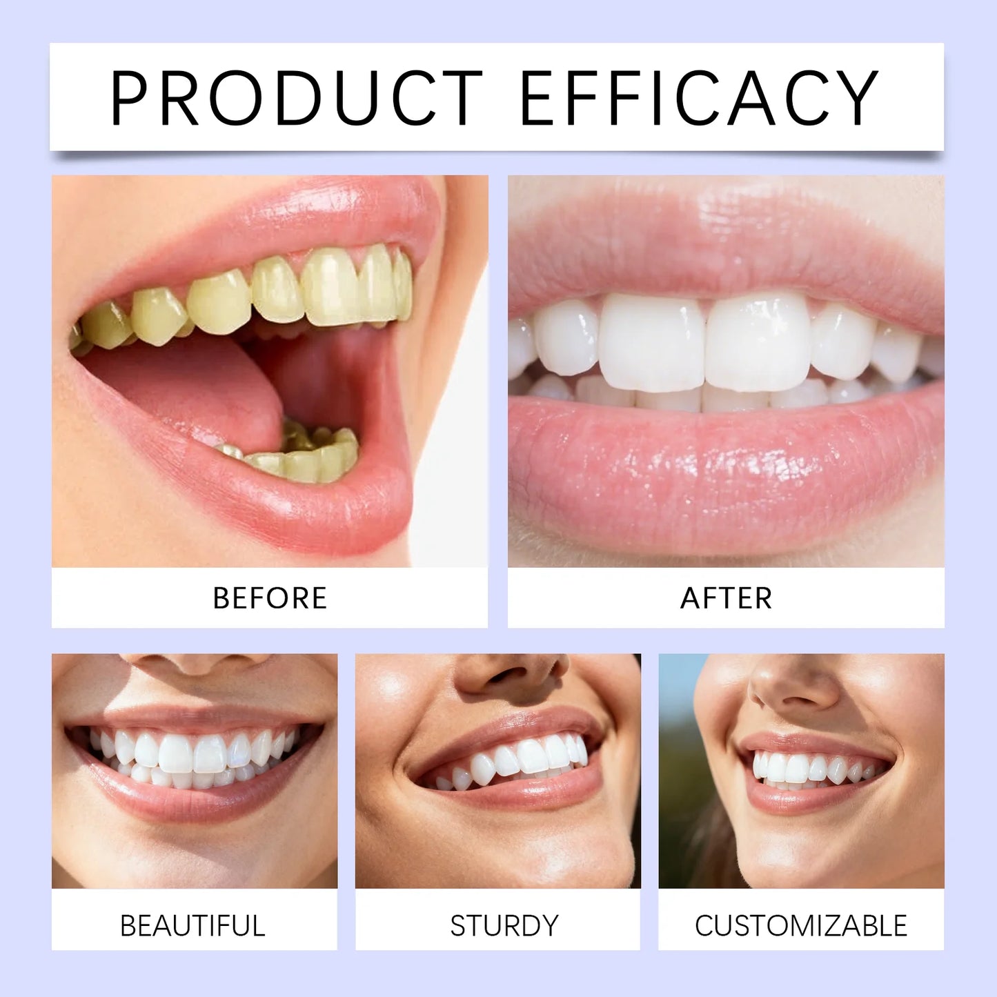 Whitening Strips