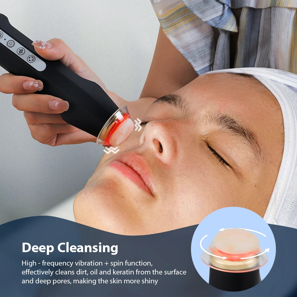 Oxygen Bubble Facial CO2 Pen Aqua Skin Face