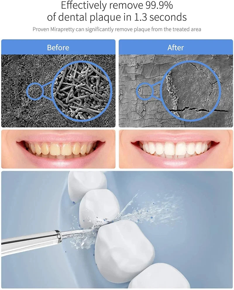 Oral Irrigator Multifunctinal Flosser Tooth Cleaner 600ml Electric