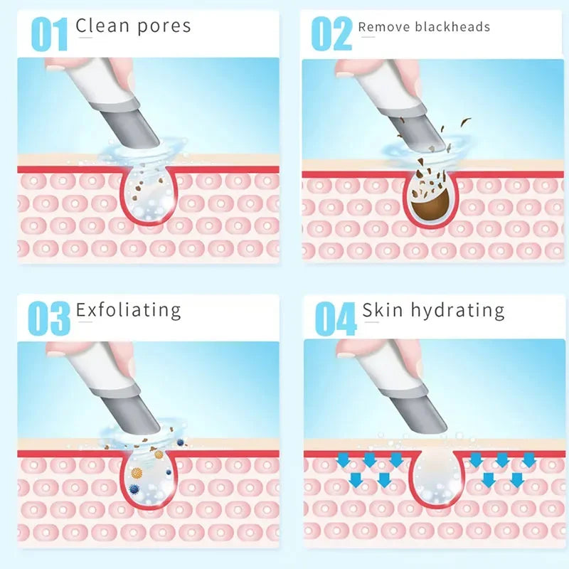 Peeling Beauty Device Bubble Oxygen Injection