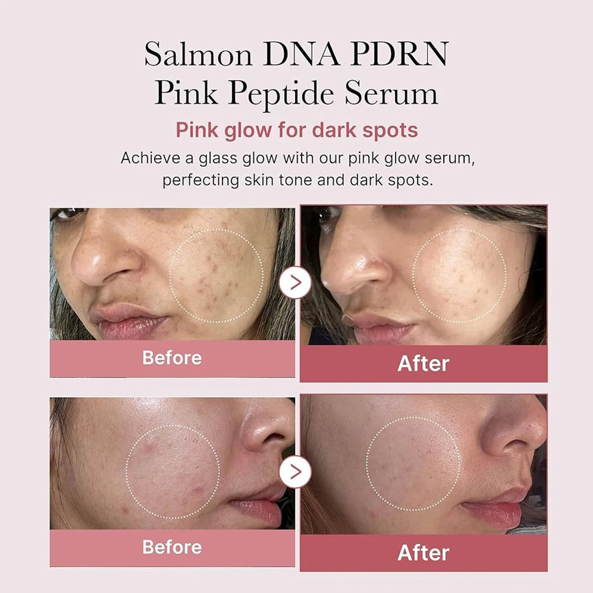 Salmon DNA PDRN Pink Peptide Serum